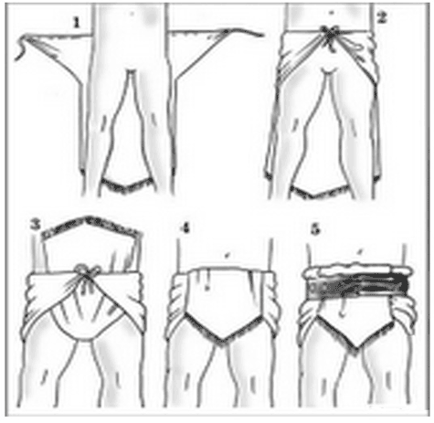 Subligaculum — Roman underwear